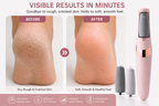 Electric Callus Remover — Smooth, Soft Feet in Minutes