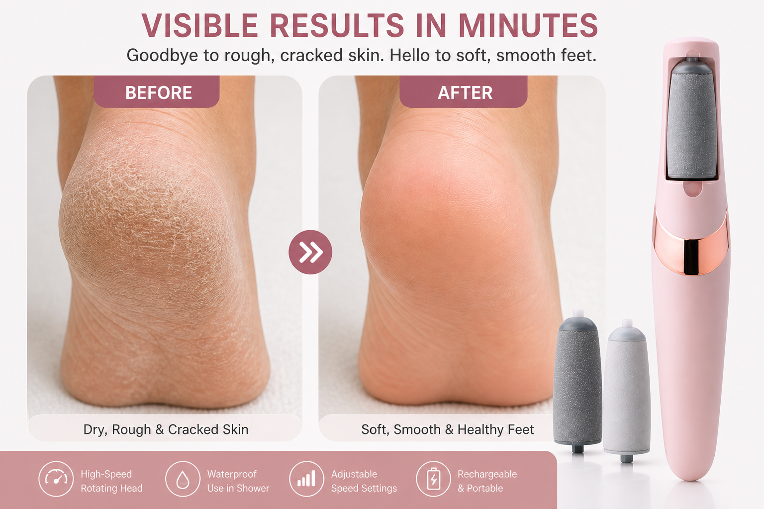 Electric Callus Remover — Smooth, Soft Feet in Minutes