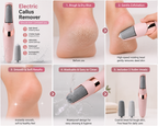 Electric Callus Remover — Smooth, Soft Feet in Minutes